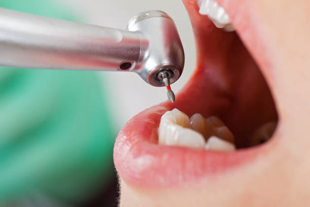 Best Emergency Treatment for Jaw Pain or Injury in Irrigon, OR